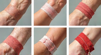 Die 6 häufigsten Fehler bei Wundheilung